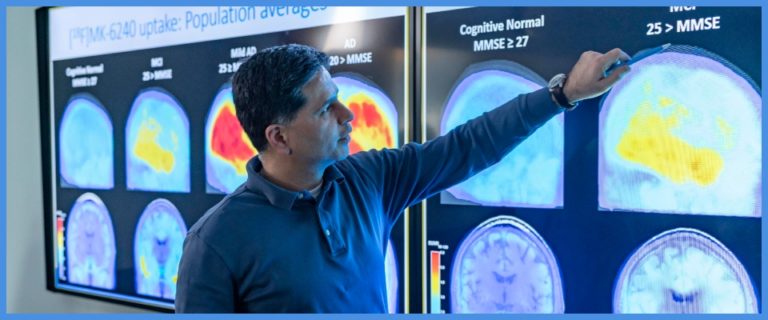 Alzheimer, un test delle urine potrebbe svelarlo e un nuovo farmaco rallentarne i sintomi 1 Alzheimer 1