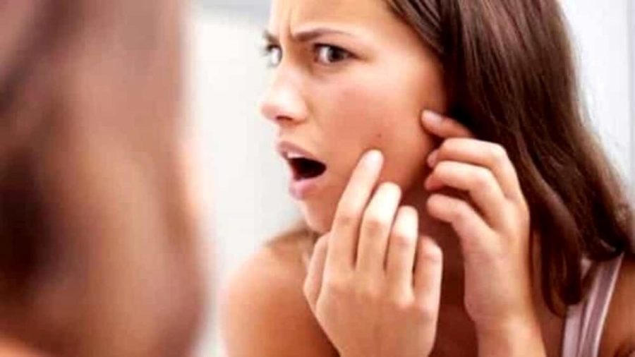 Incubo acne, cause e rimedi: come eliminarla con i metodi naturali