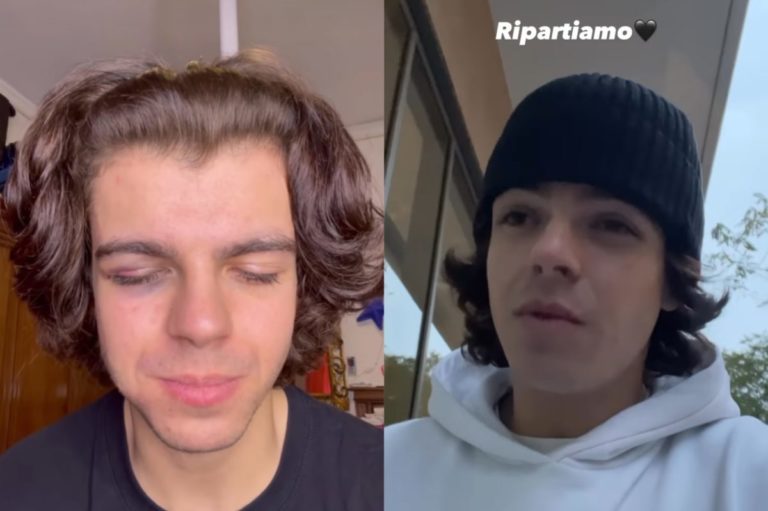 Florin Vitan torna sui social dopo la brutta aggressione di Halloween: “Ecco come sto ora” 1 florin aggredito scaled 1