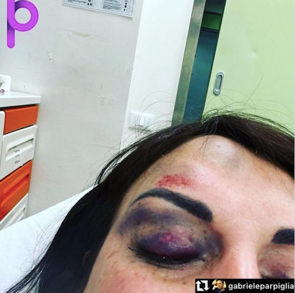 francesca de andre oggi aggressione ex fidanzato foto2