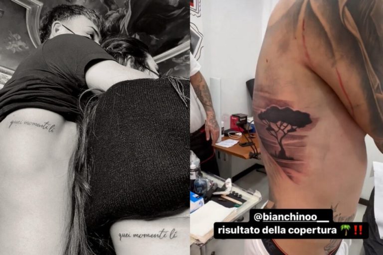 Nicolo Bianchino tatuaggio rimosso 1024x683 1