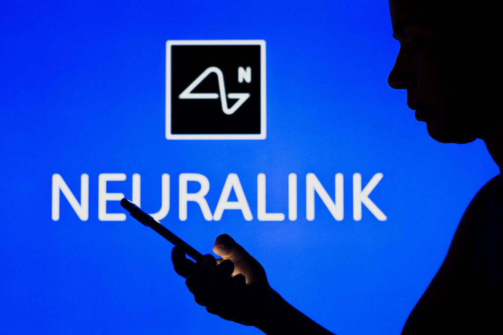 Neuralink, via libera della FDA ai test sull’uomo 1 gettyimages 1240407858