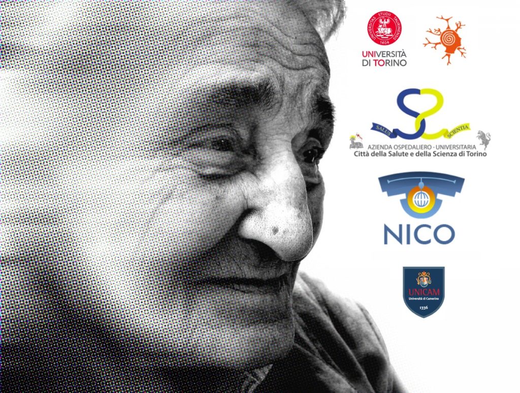 legame diretto tra sonno e Alzheimer