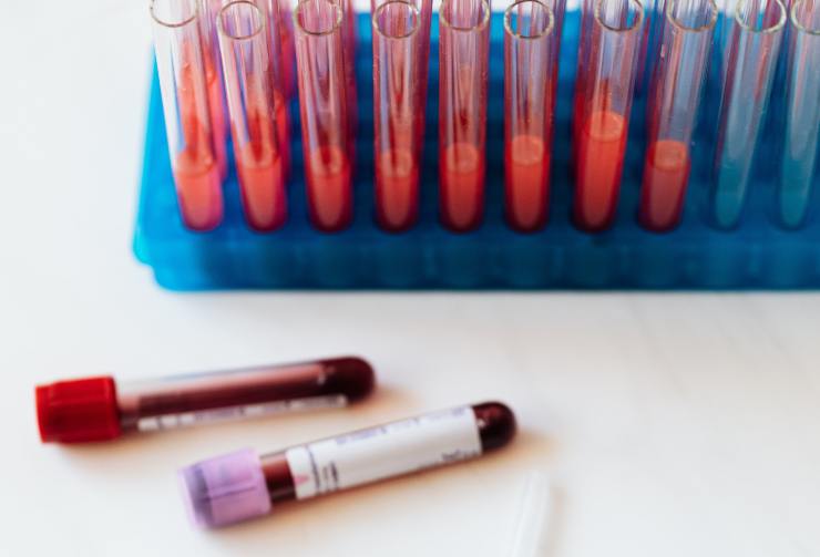 analisi del sangue