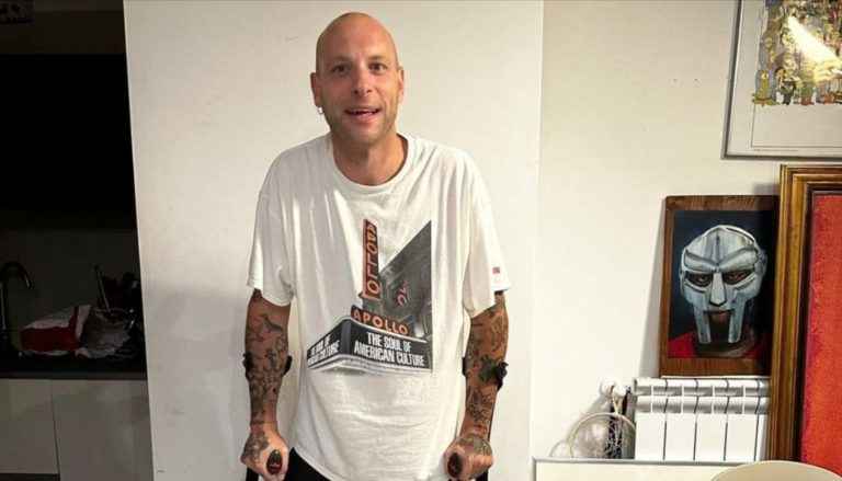 Clementino, un infortunio mette a rischio il concerto: come sta oggi il rapper? 1 Clementino 1 1024x585 1