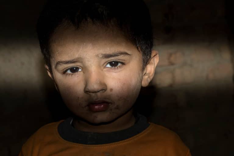 SH bambino triste vittima guerra profugo.jpg
