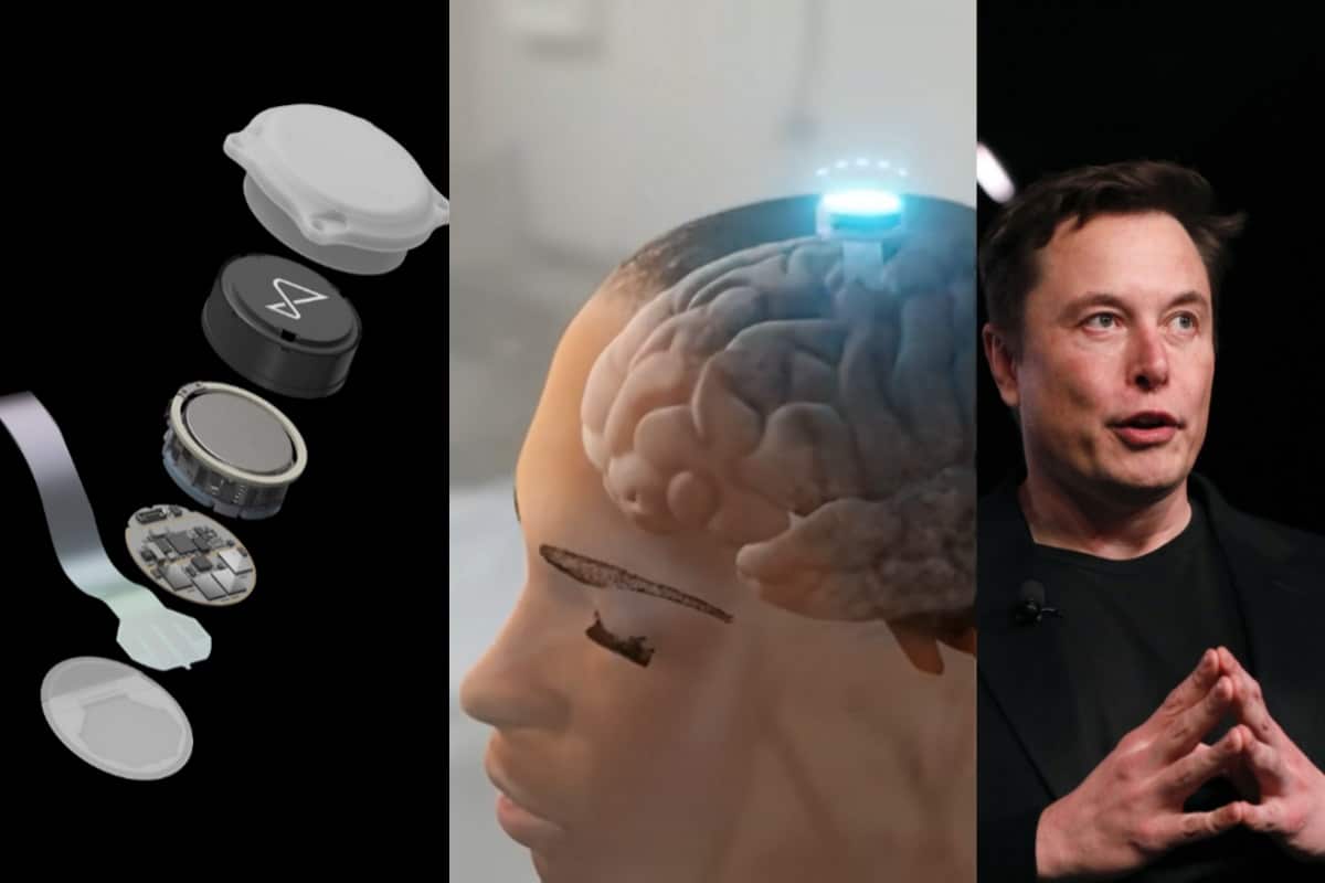 neuralink 1.jpg