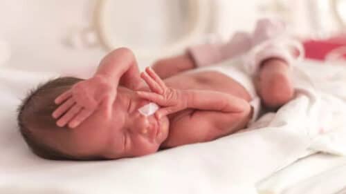 premature baby 2 500x281.jpg