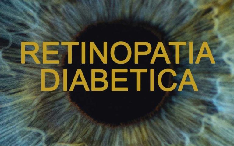 retinopatia diabetica screening Occhio e Diabete dallo Screening alle innovazioni diagnostiche e terapeutiche.jpg