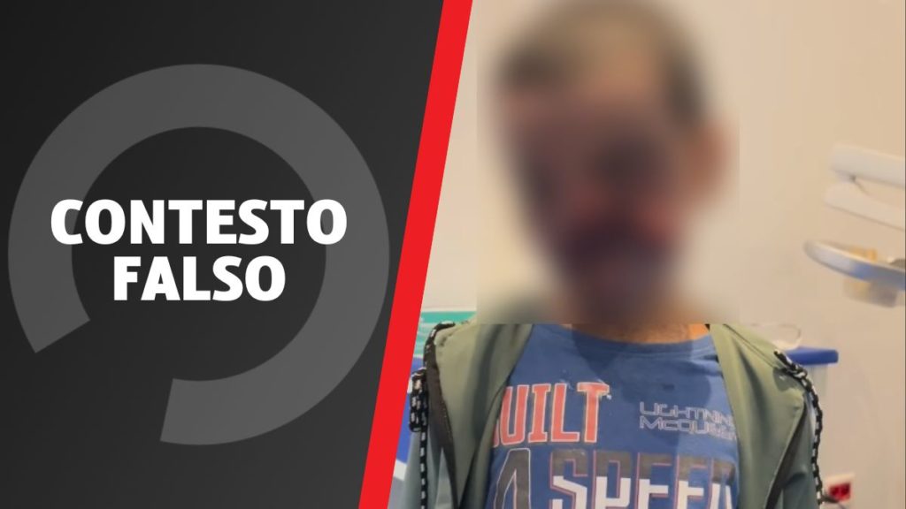 bambini palestinese sfigurato israele fake.jpg