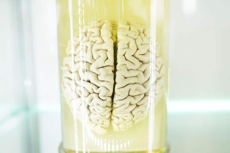 Un cervello di maiale mantenuto in vita al di fuori del corpo per cinque ore 1 brain m.jpg