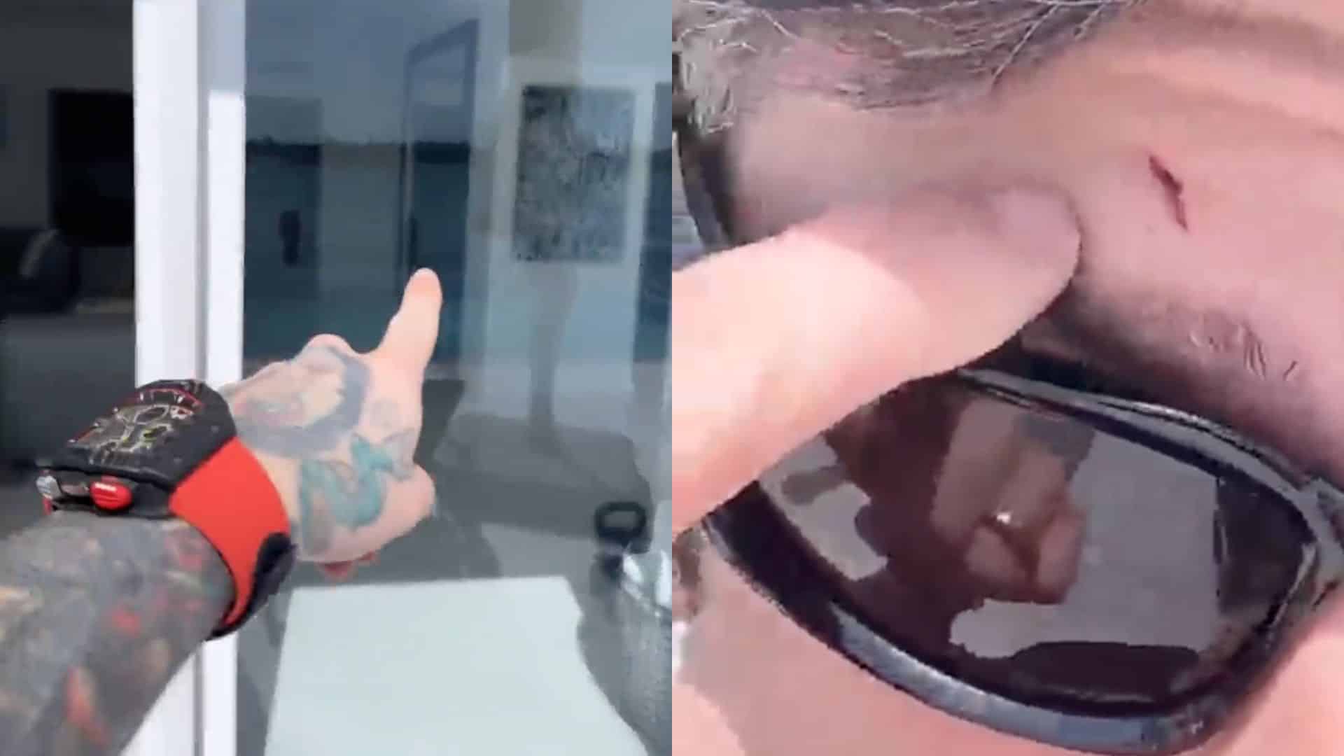 La disastrosa avventura di Fedez a Miami per lavoro: persa la valigia nel volo, non vede il vetro e si ferisce – Il video 1 fedez volo.jpg