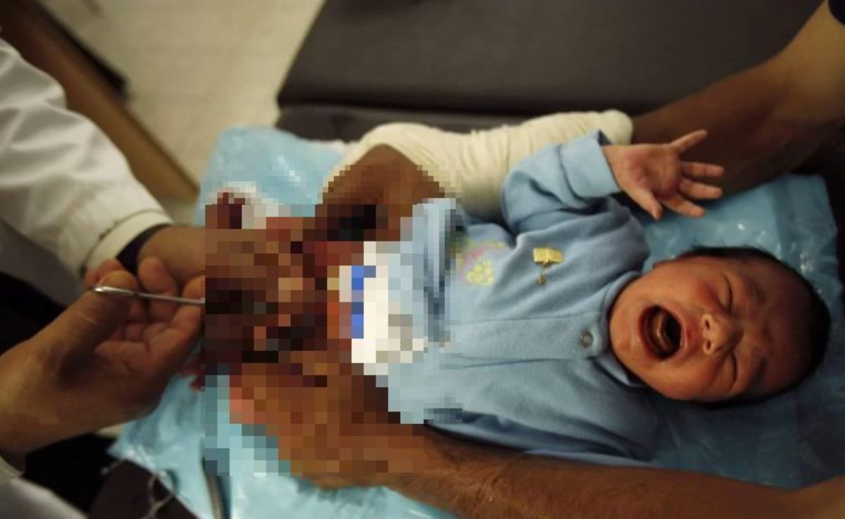 Velletri, neonato morto per una circoncisione abusiva: condannate tre donne 1 neonato morto circoncisione.jpg