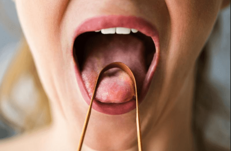 tongue m.png