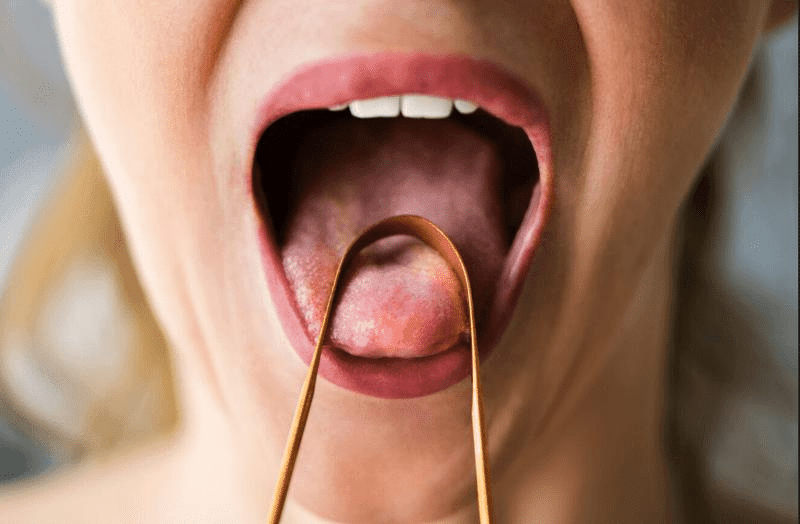 tongue m.png