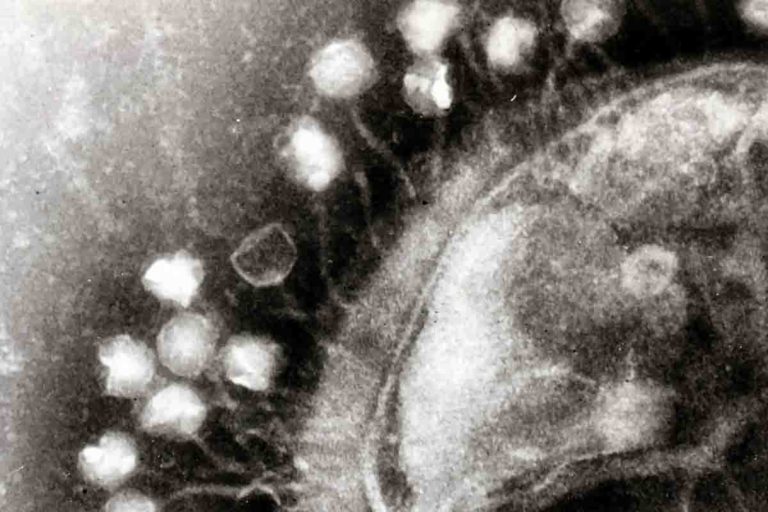 virus batteriofagi su un batterio.jpg