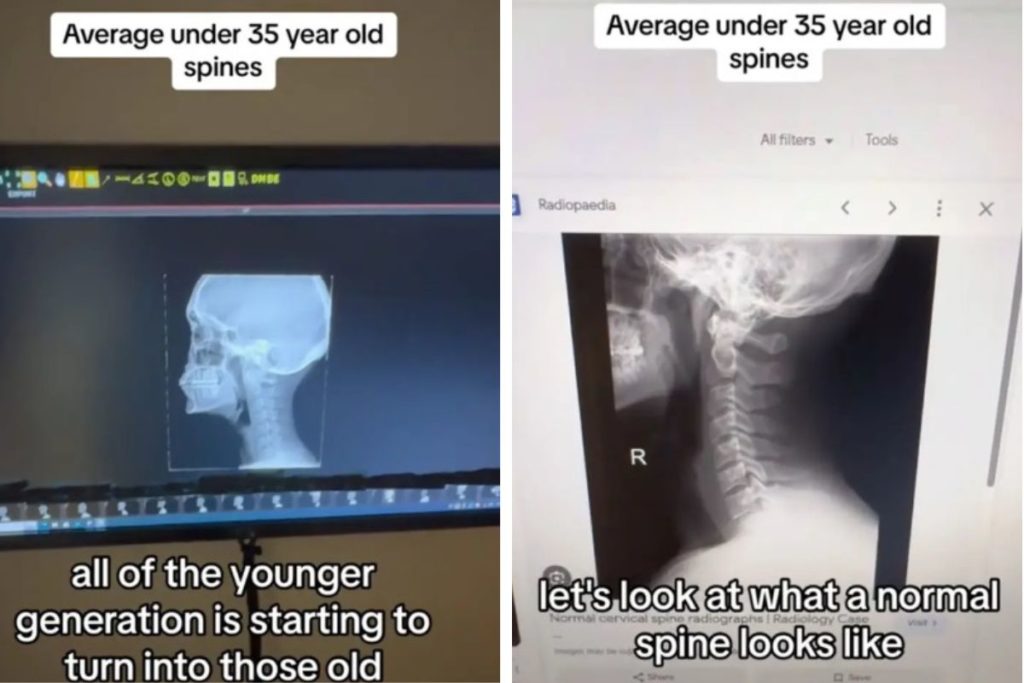 chiropratico radiografie giovani.jpg