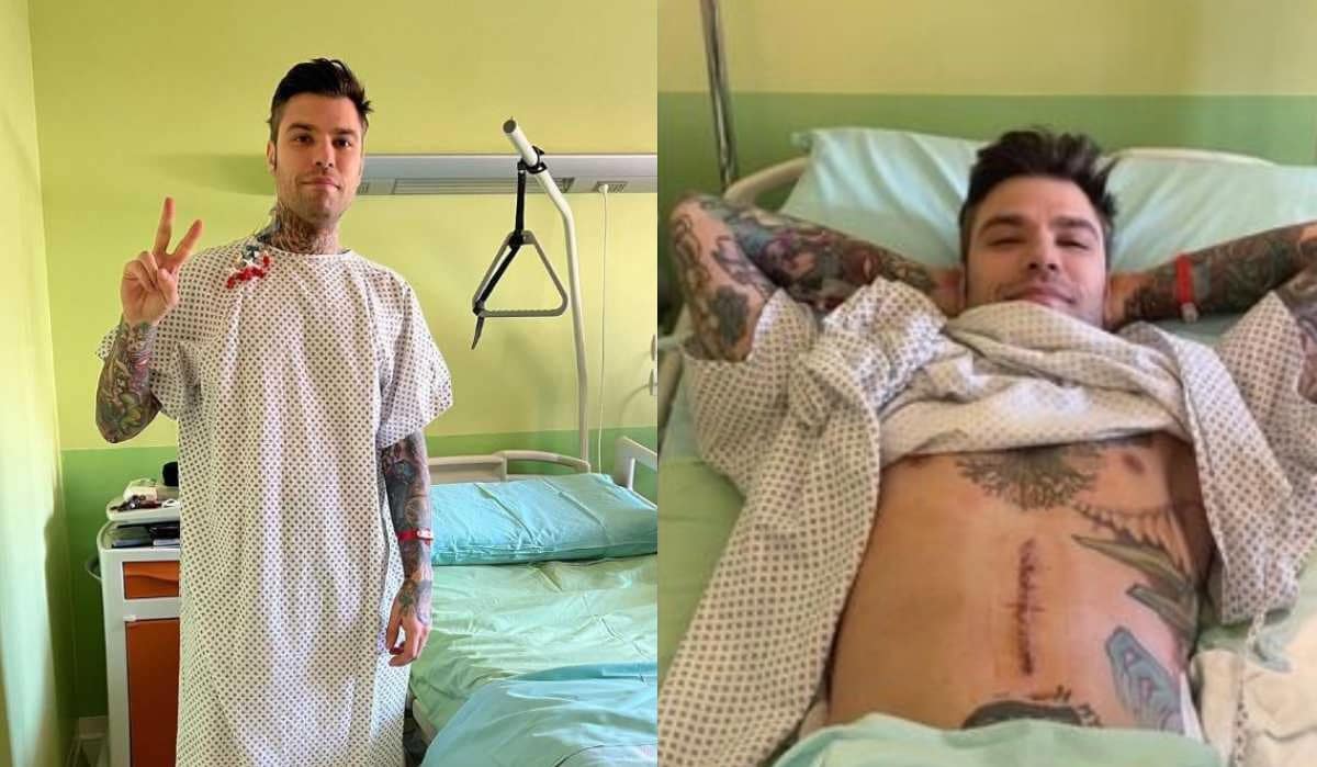 fedez ricoverato seconda operazione come sta.jpg