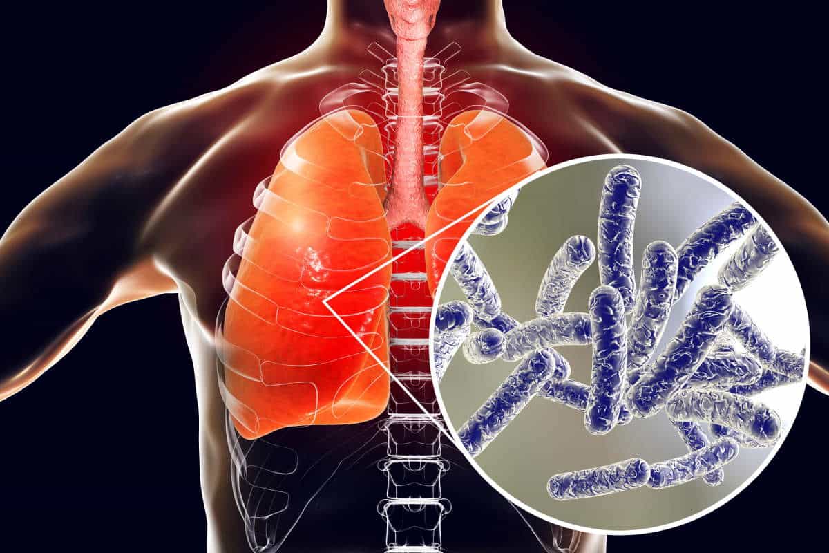 Misterioso e rapido aumento dei casi di legionella legati allla qualità dell’aria (inaspettatamente dove è più pulita) 1 legionella 1.jpg
