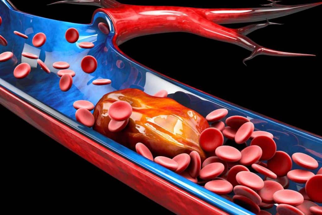 coaguli sangue.jpg