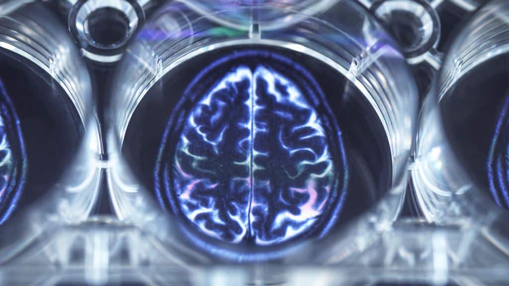 Il cervello umano è diventato più grande negli ultimi 90 anni. Le possibili spiegazioni 1 i592745.jpeg
