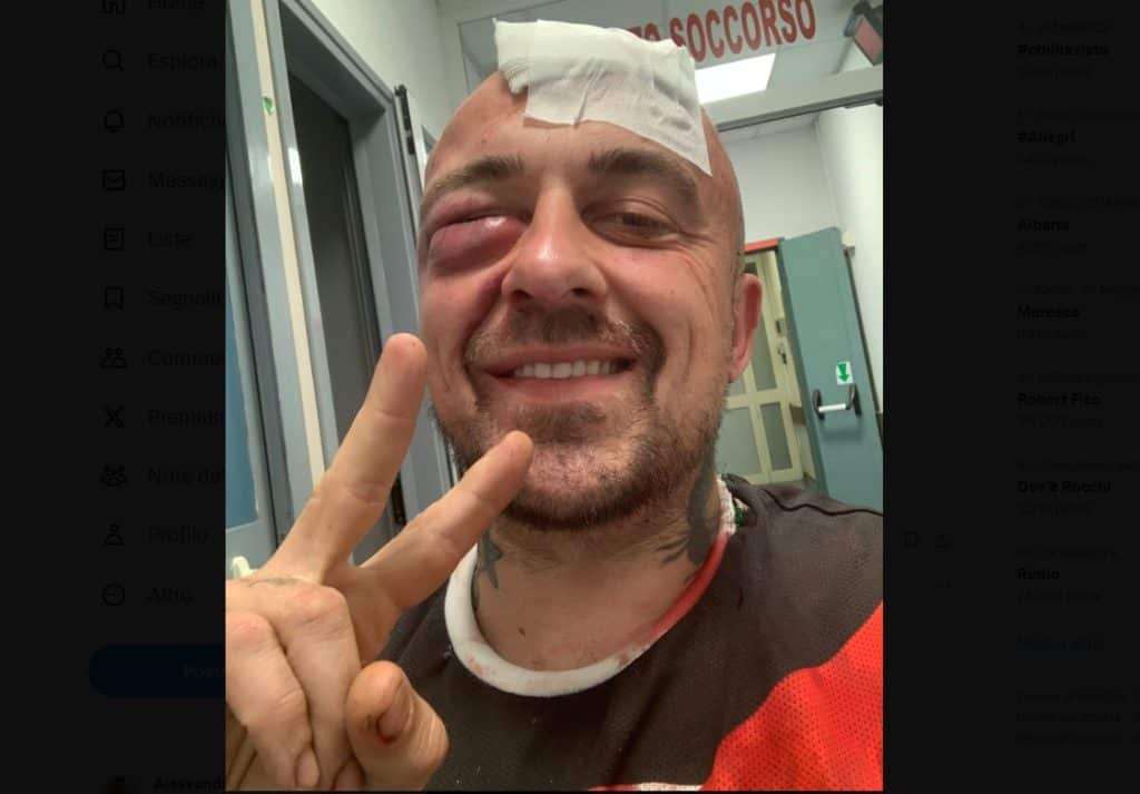 chef rubio massacrato botte pronto soccorso.jpg