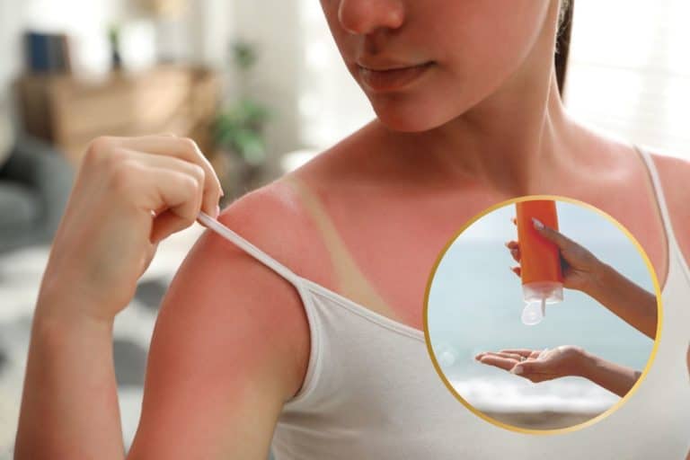 scottatura crema solare.jpg