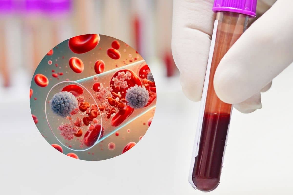 Rimuovere i Pfas dal sangue in tempi record? Ora è possibile grazie all’invenzione di un medico italiano 1 Progetto senza titolo 35.jpg