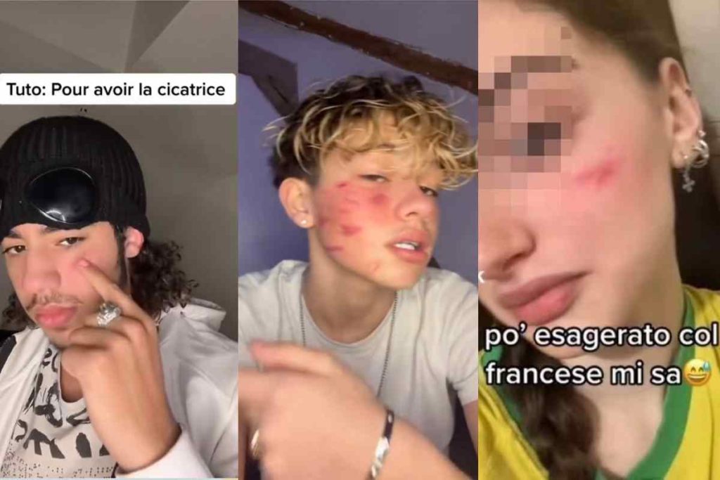 cicatrice tiktok.jpg