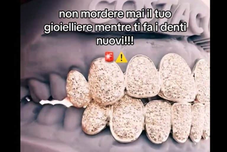 costacurta dentiera diamanti.jpg
