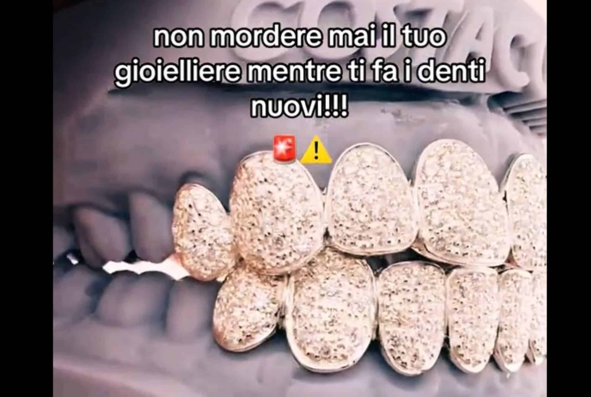 costacurta dentiera diamanti.jpg