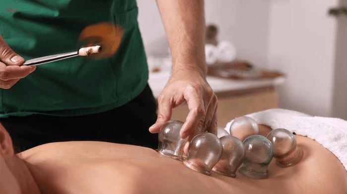 Coppettazione: antica pratica per il benessere fisico 1 cupping m.png