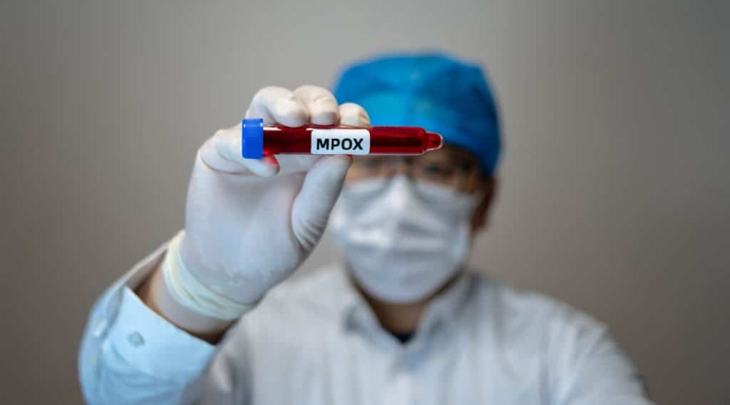 mpox.jpg