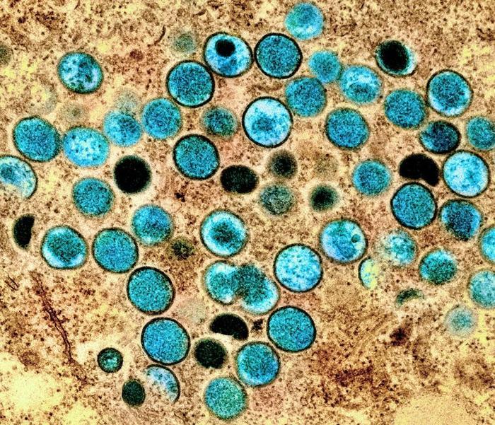 mpox virus m 1.jpg