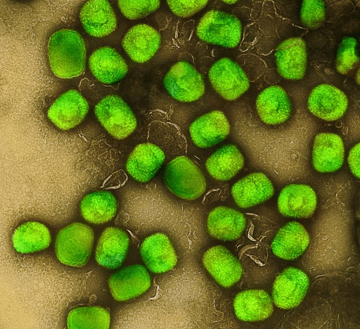 mpox virus m 1.png