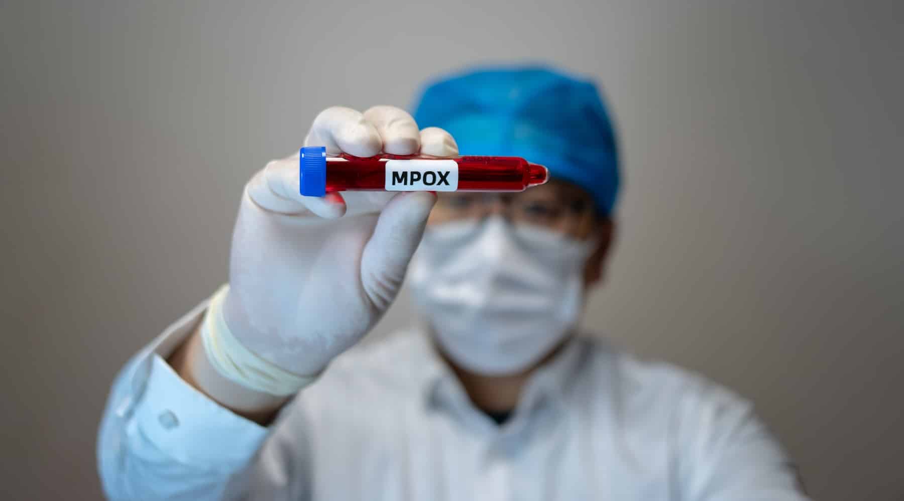 Mpox: quali sono i sintomi, cosa rischia chi viene contagiato, perché i casi sono in aumento. E perché non va chiamato «vaiolo delle scimmie» 1 mpox.jpg