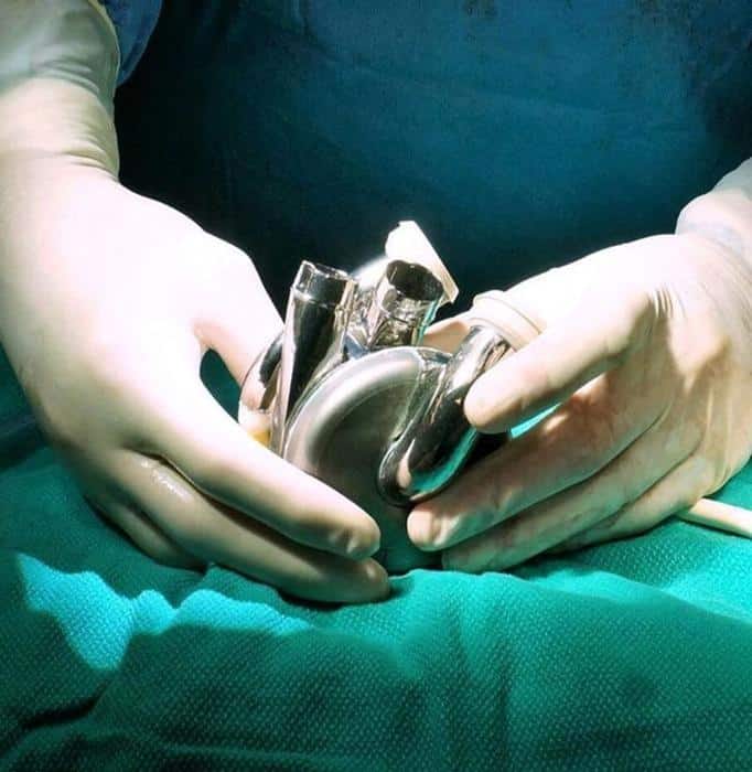 Il cuore di titanio di BiVACOR: una svolta nel trattamento dell’insufficienza cardiaca 1 photograph of the shiny titanium bivacor total artificial heart grasped by two white latex gloved hands resting on a turquoise sheet m.jpg