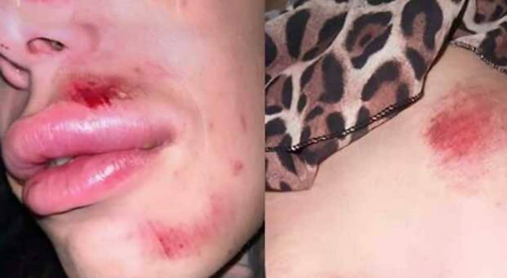 ragazze trans viterbo.jpg