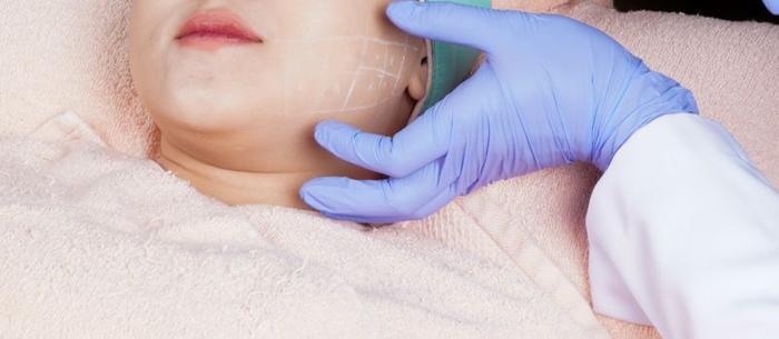 facial surgery m.jpg