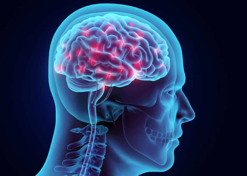 epilessia.jpg