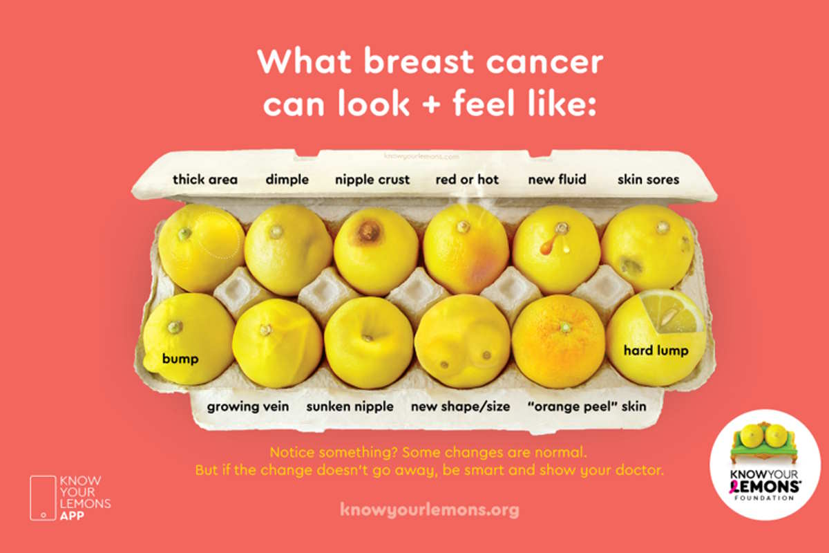 “Il tuo seno è come uno di questi limoni? Corri subito dal dottore”: la geniale campagna di prevenzione del cancro mammario 1 limoni cancro.jpg