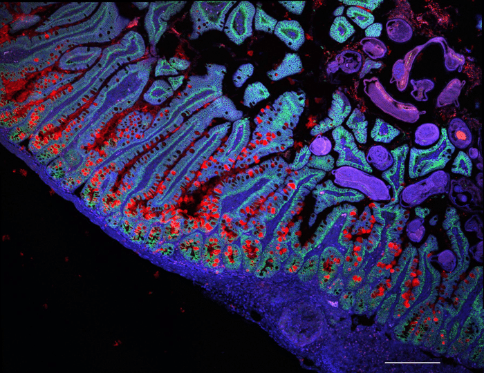 The human small intestine Image credit Grace Burgin Noga Rogel Moshe Biton Klarman Cell Observatory Broad Institute.png