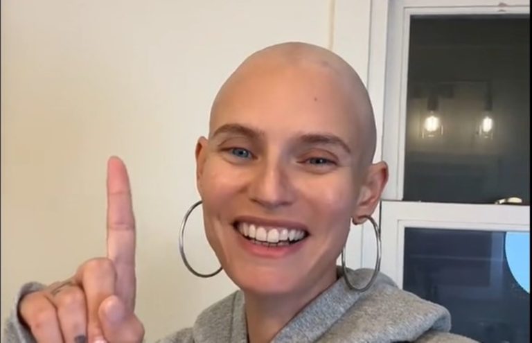 Bianca Balti si confessa alle Iene dopo l’asportazione del tumore: «Non camminavo dal dolore, ho pianto per le bambine» – Il video 1 bianca balti capelli rasati zero.jpg
