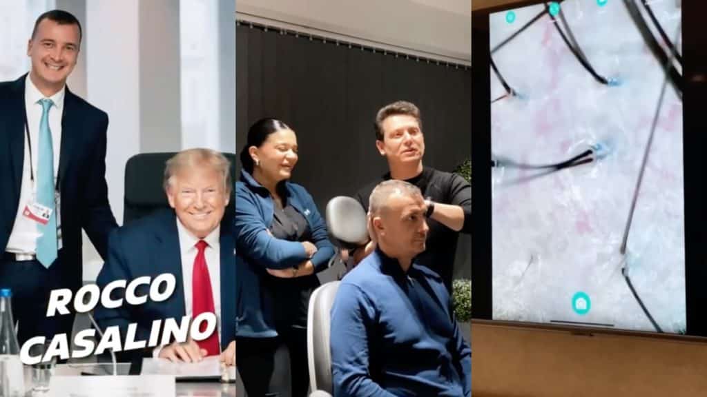 rocco casalingo trapianto capelli florio.jpg