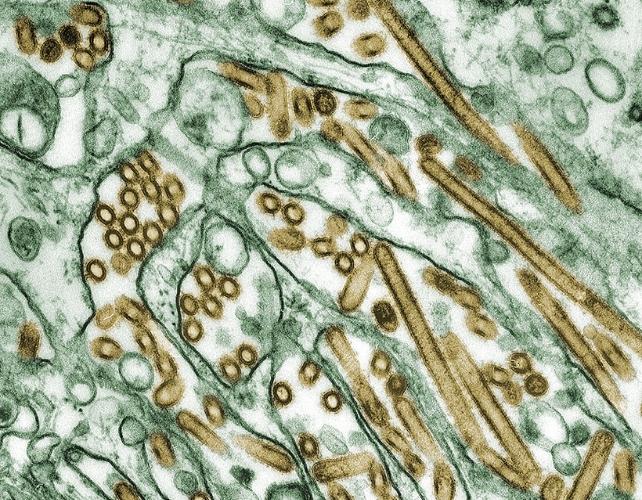 Colorized transmission electron micrograph of Avian influenza A H5N1 viruses 1.jpg