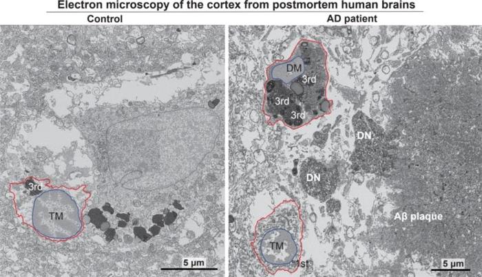 Dark Microglia 777x448 1.jpg