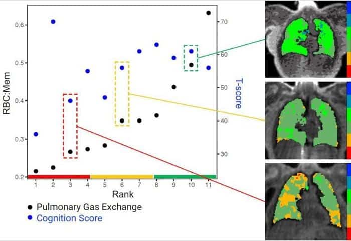 Long COVID Brain Fog Lung Function Graphic 777x533 1.jpg