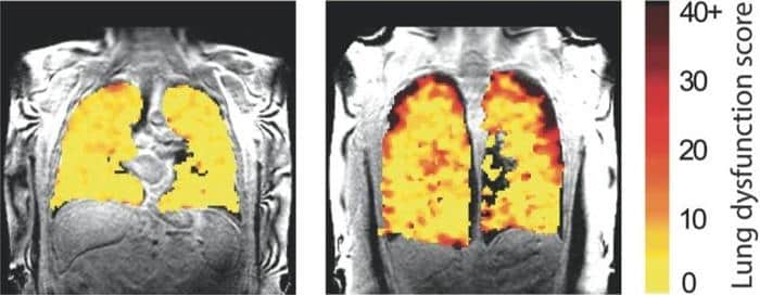 Lung Function MRI 777x303 1.jpg