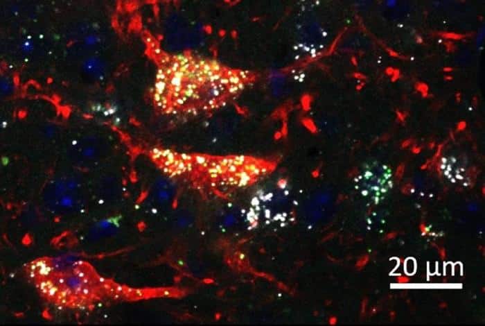 Midbrain Neurons Co Expressing the Mu Opioid Receptor and Cannabinoid Receptor 1 777x522 1.jpg