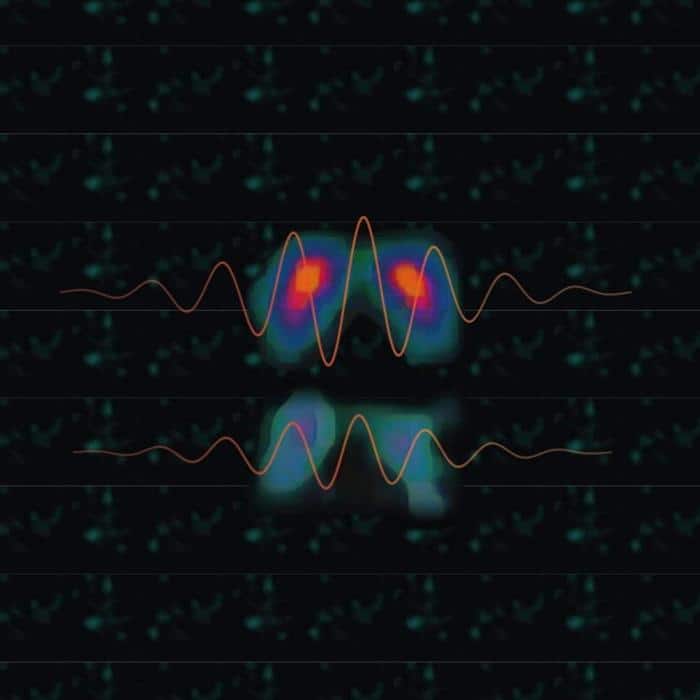 New Perspective on Tremor in Parkinsons Disease 777x777 1.jpg